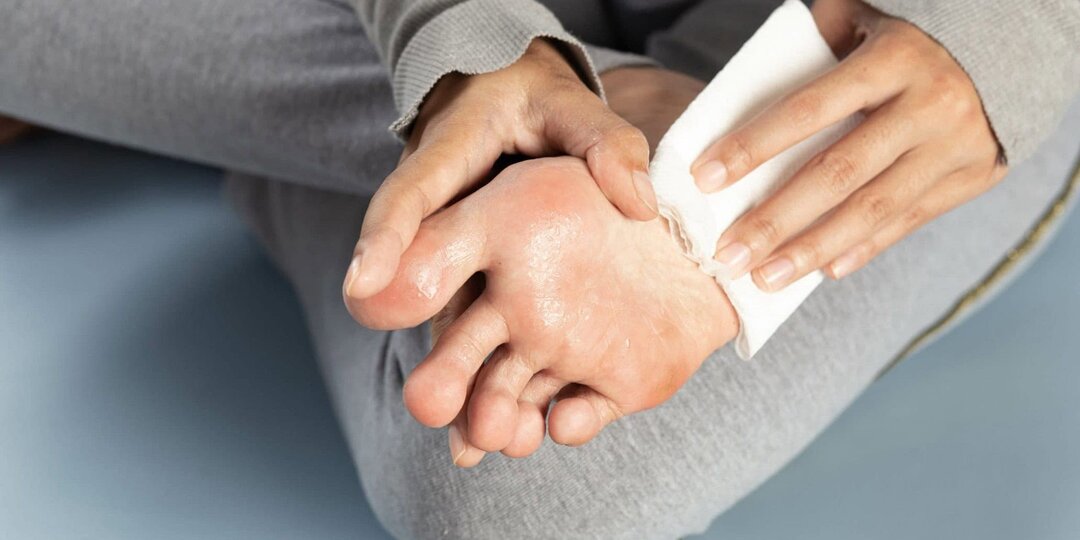 Что делать если сильно потеют ноги? Советы подолога с 15-летним стажем