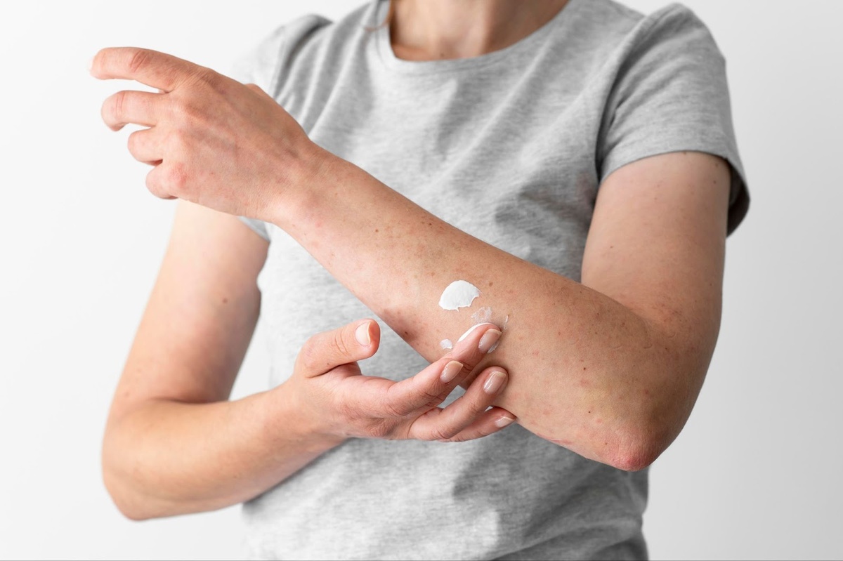 Источник изображения: freepik.com/free-photo/skin-allergy-reaction-person-s-arm_19672602.htm