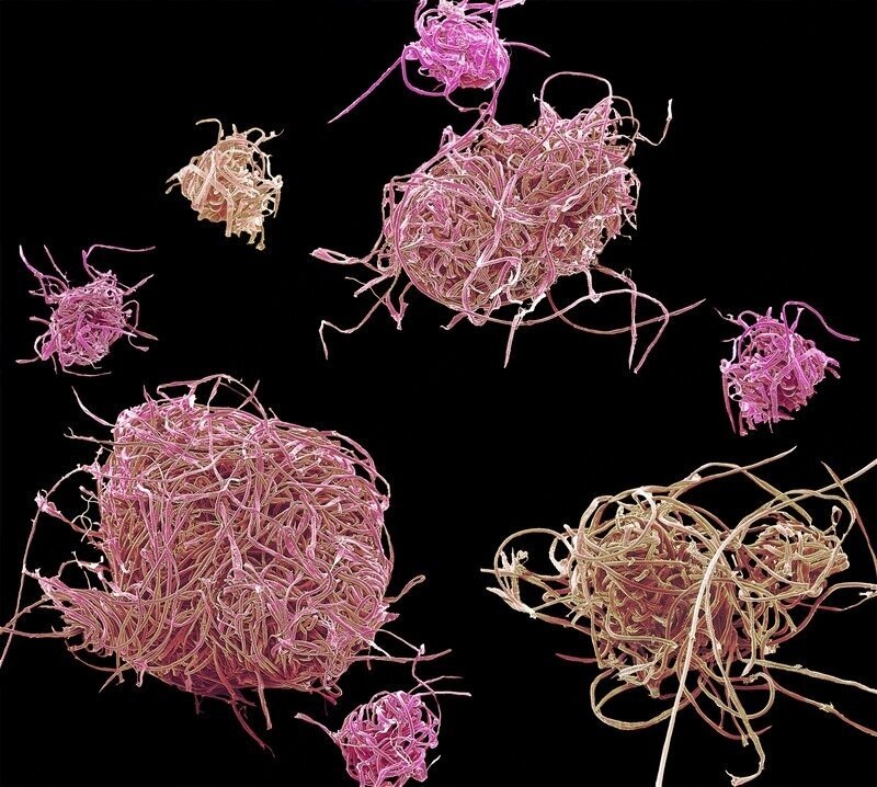 Микро пластик под микроскопом 