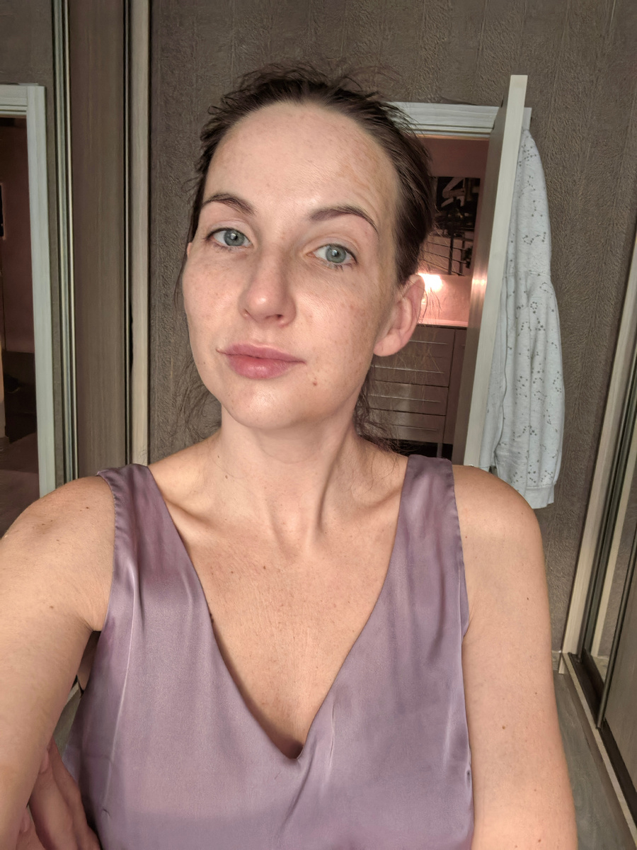 Утро 5-ого дня после операции