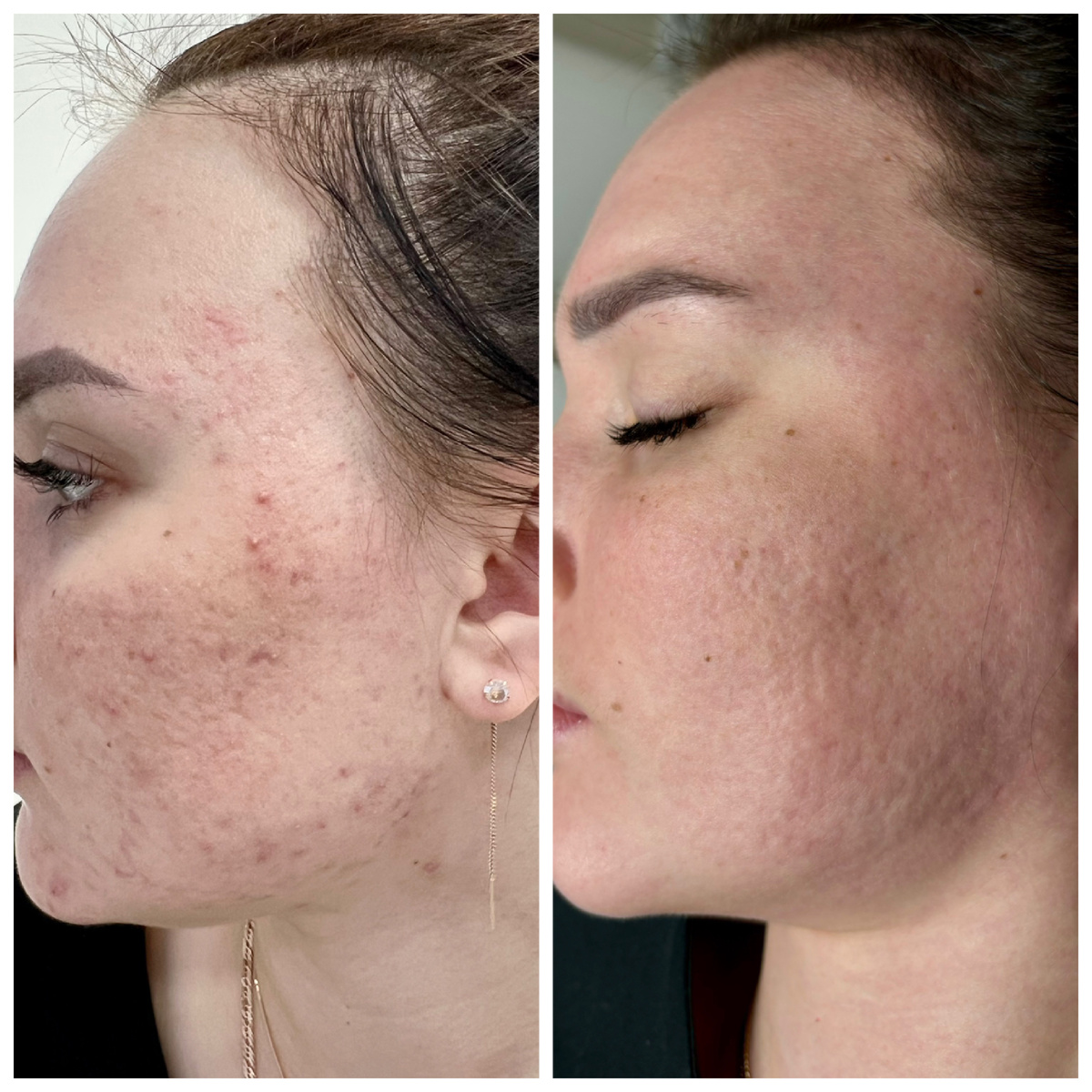 Фото из личного архива врача дерматолога Тимачевой И.А.