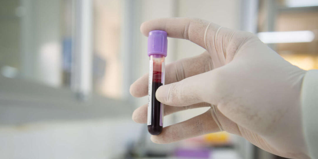 Важность гематологического анализа для сохранения здоровья