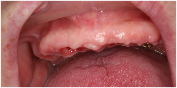 *пациентка стоматологии АИСТ до лечения