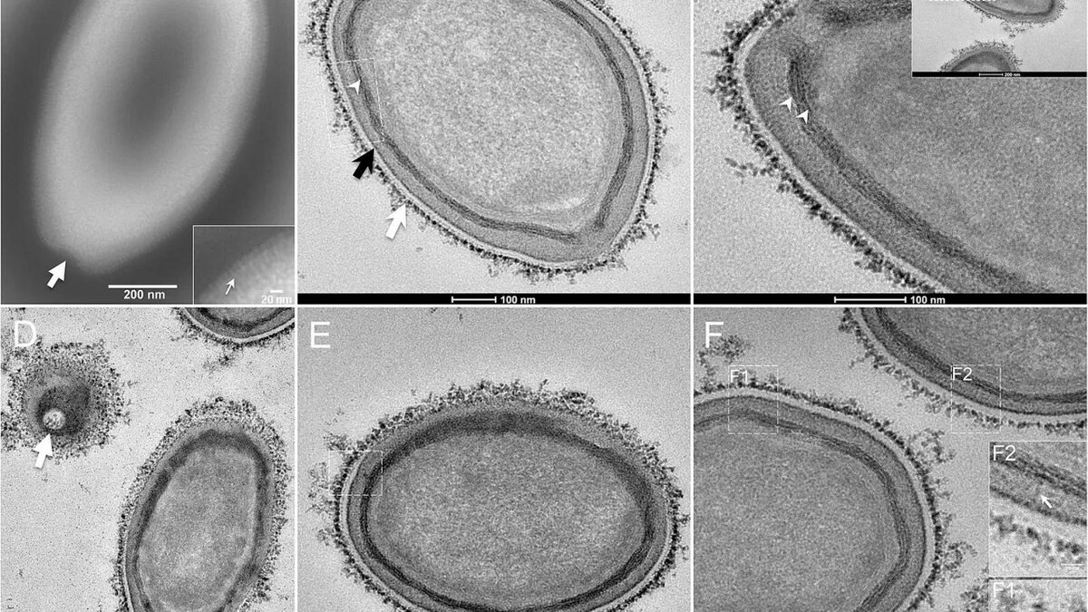 Вирусы под микроскопом найденные в Сибири, фото с https://inbusiness.kz/