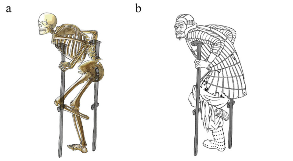  Ruiqi Zou et al. / International Journal of Osteoarchaeology, 2025