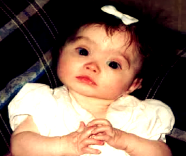 Малышка, болеющая синдромом кошачьего крика