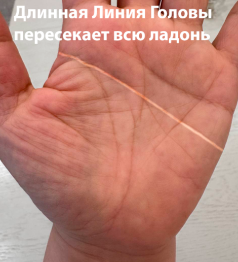 Признак Сидней