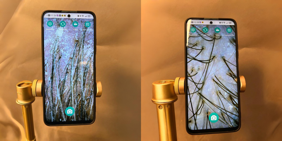 Кожа головы при осмотре до и после специального комплекса в Про Лицо и Тело