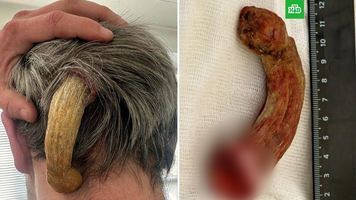    Фото: bolnica5_chelny / t.me