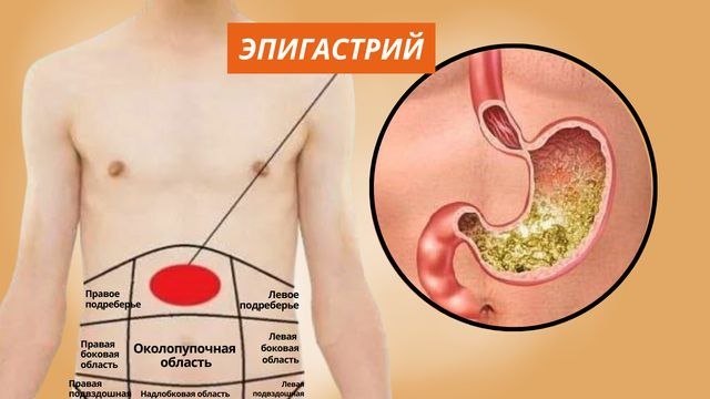 Карта боли живота: 7 болезней, которые можно определить по локализации боли. Не потеряй шпаргалку