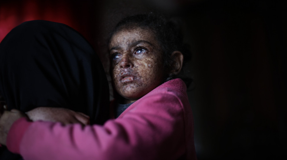    XP — генетическая болезнь превращающая солнце в смертельную угрозу