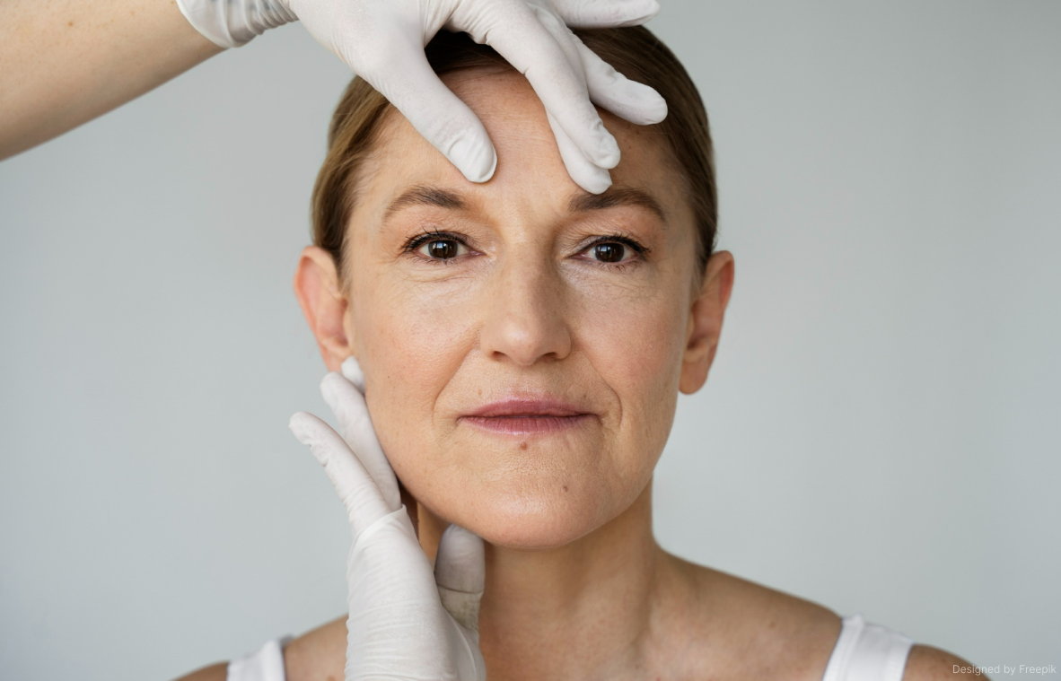 Мимический залом со временм становится только глубже, поэтому нуждается в коррекции мягким филлером