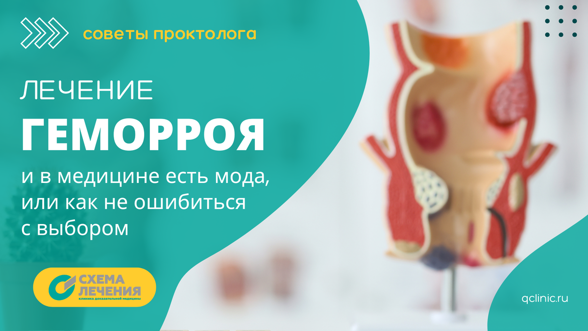 Как лечить геморрой? Советы проктолога