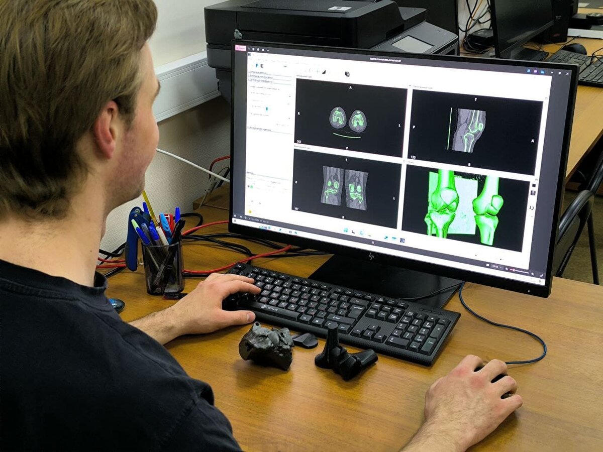    Лаборант кафедры цифровых и аддитивных технологий РТУ МИРЭА Ярослав Вышенеев по снимкам МРТ создает реконструкцию поврежденного сустава / © Ростислав Сиделев, Институт перспективных технологий РТУ МИРЭА