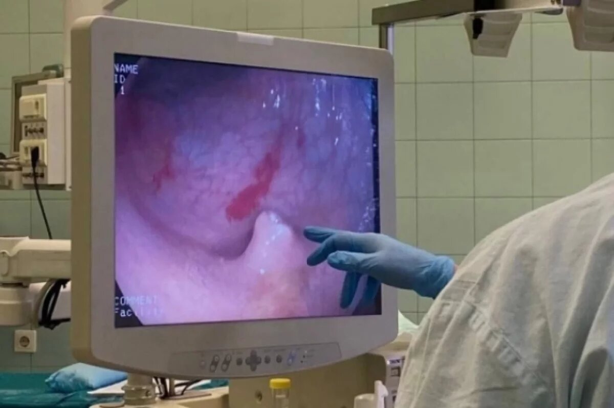    Врачи спасли юную жительницу Удмуртии с синдромом Пейтца-Егерса