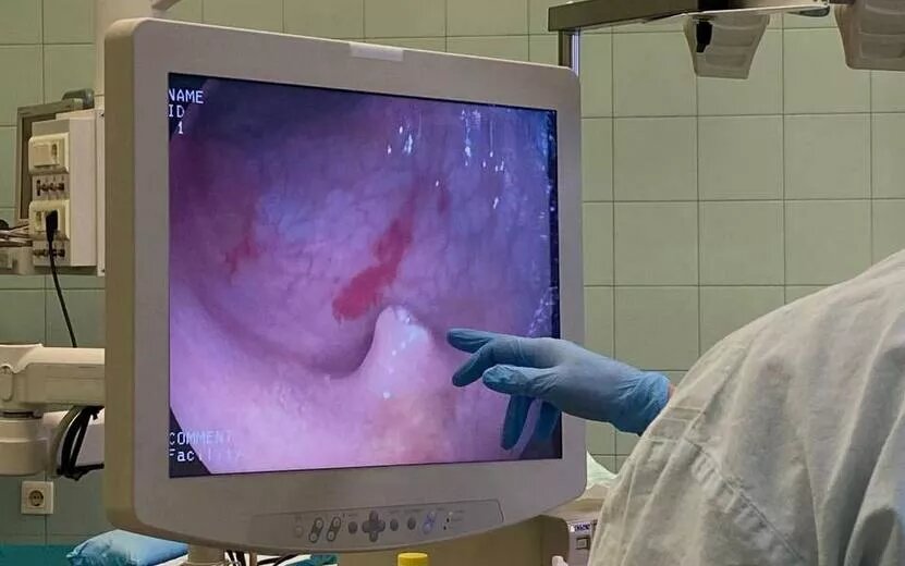    Девочку с синдромом Пейтца-Егерса спасли врачи в Ижевске