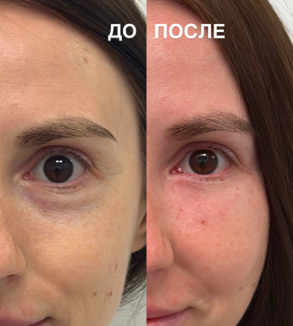 Здесь всего 10 дней после операции