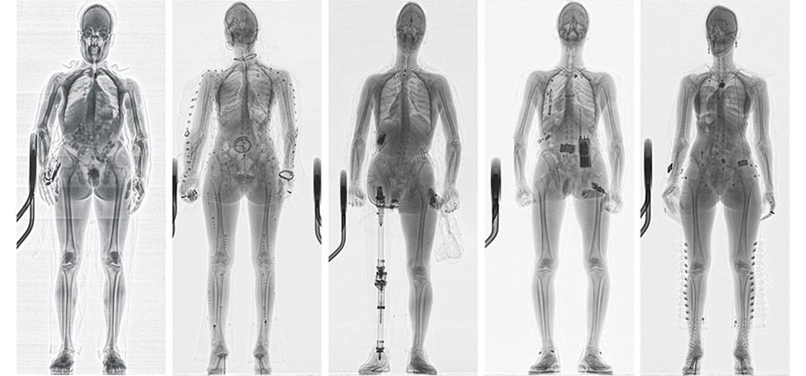 Пример получаемого изображения с рентгеновского сканера человека