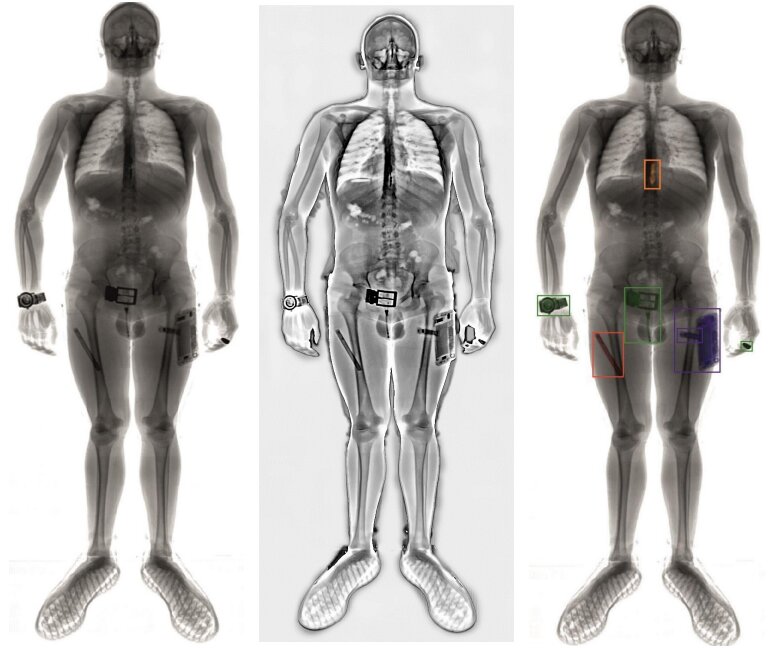Пример получаемого изображения с рентгеновского сканера человека