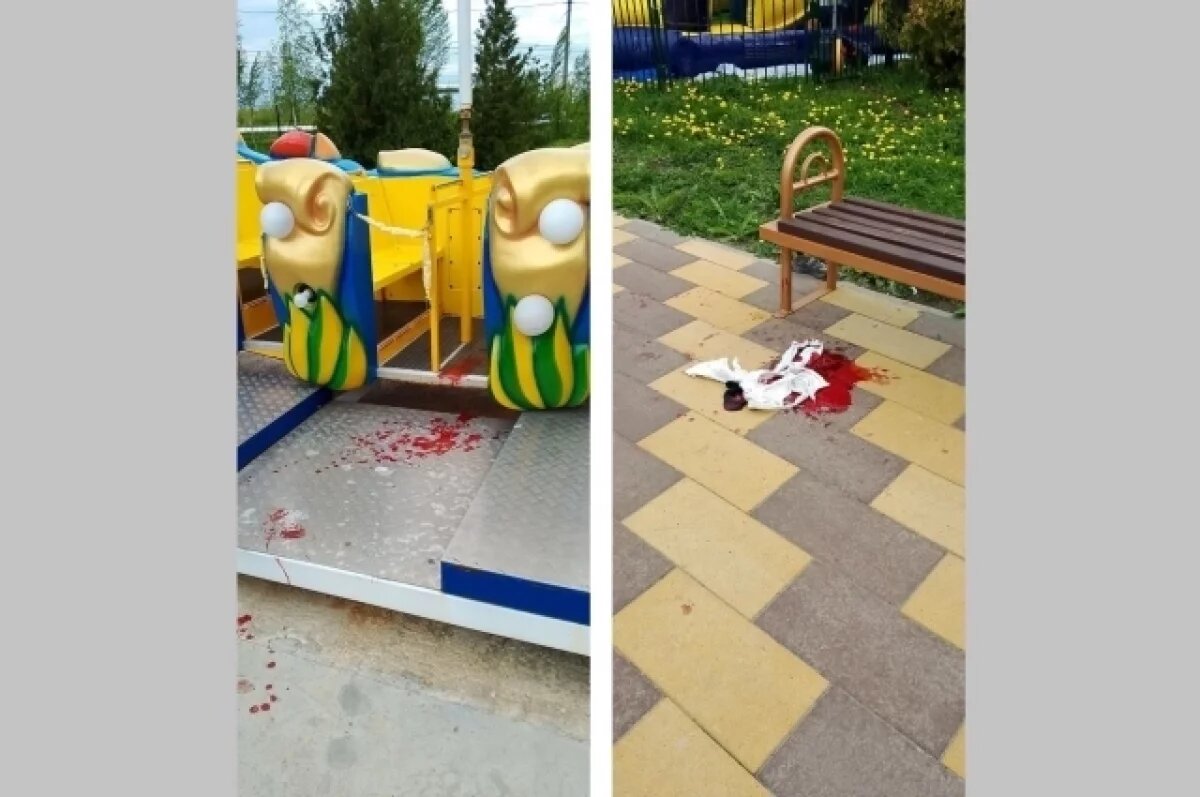    В Новокуйбышевске на аттракционе ребёнок получил открытый перелом ноги