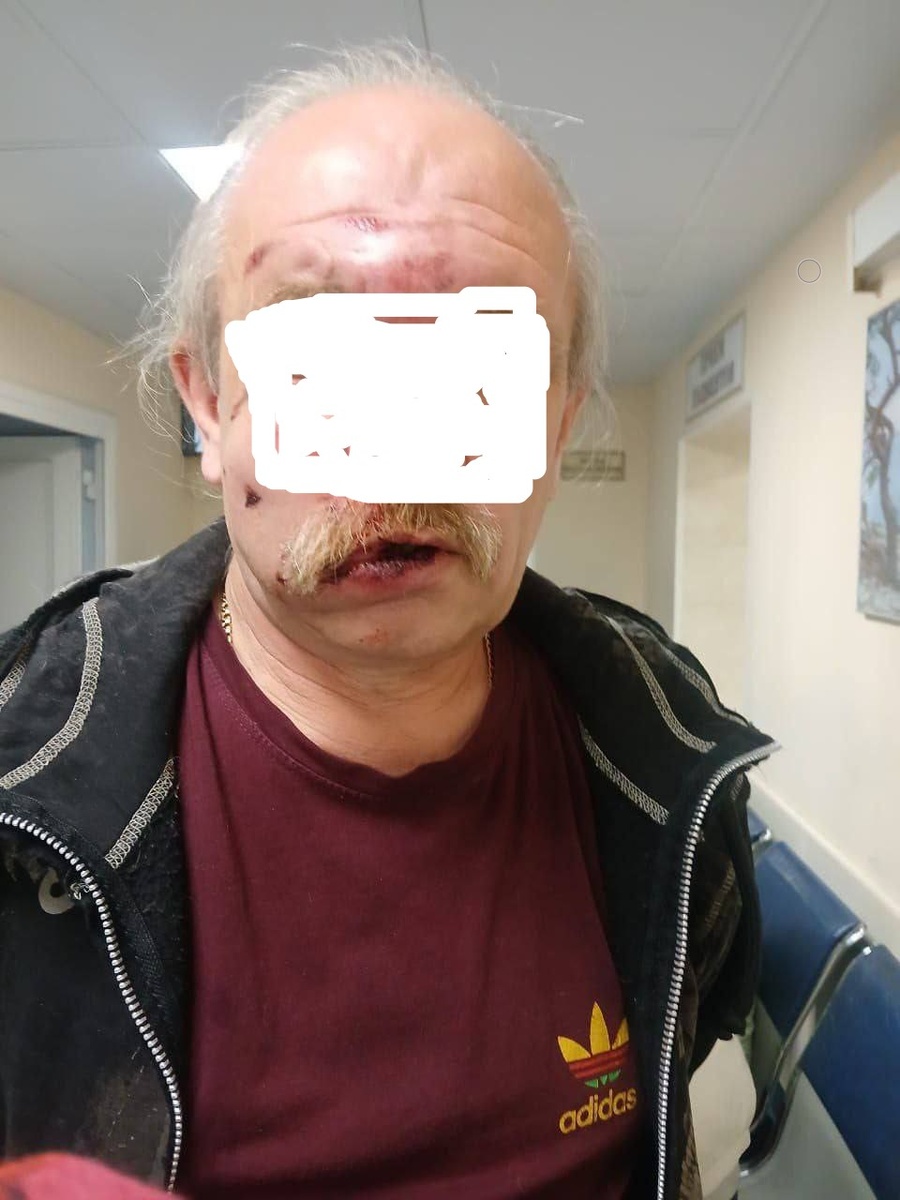 Избитый пенсионер