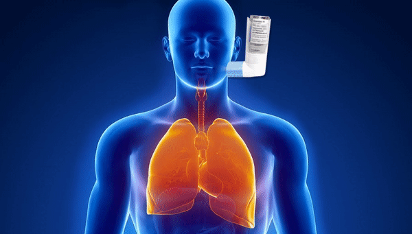 Почему астма не отступает? Разбираем 5 постоянных ошибок в лечении астмы