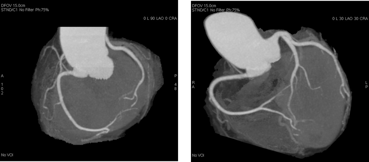 Ваше спасение этот анализ