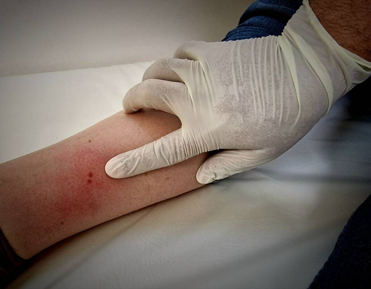 Фото: Пресс-служба челнинской горбольницы №5