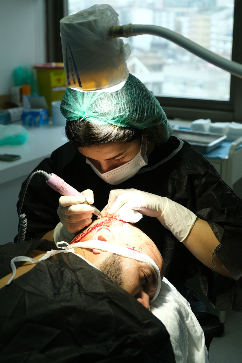 Забор донорского материала