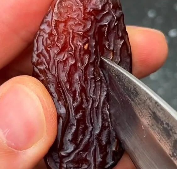 Правый бок тянет? Возможно, всё дело не в еде. Я нашла 3 настоящих причины