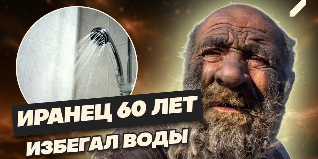Прожил 94 года в грязи, питался отходами – история иранца, который не мылся 60 лет