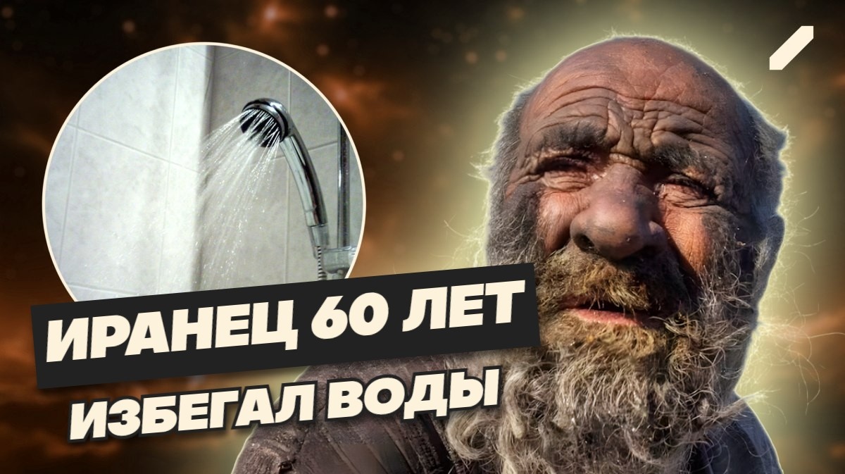 Прожил 94 года в грязи, питался отходами – история иранца, который не мылся 60 лет