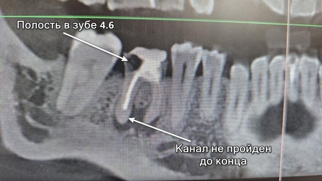 Обследование до начала лечения