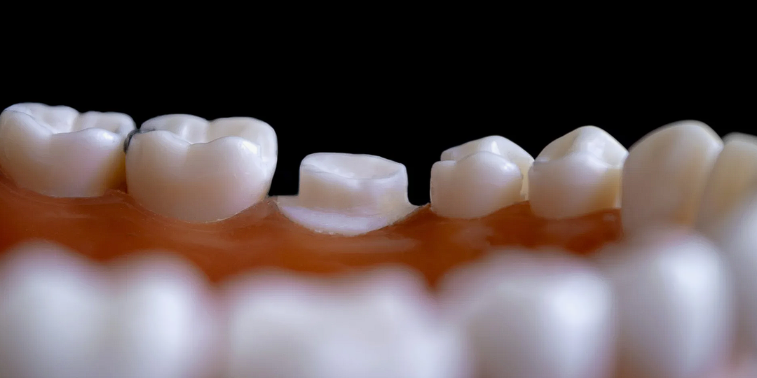 Ученые вырастят людям новые зубы — клинические испытания уже начались