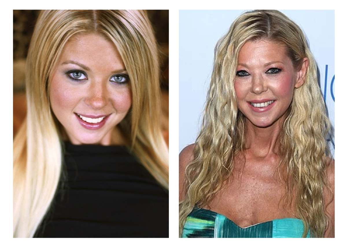 Тара Рид до и после пластики.