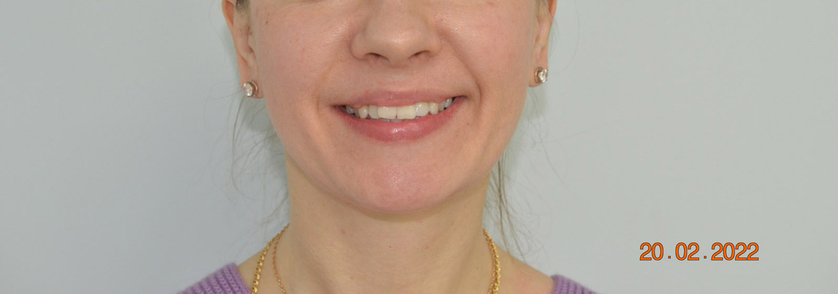 Исходное состояние