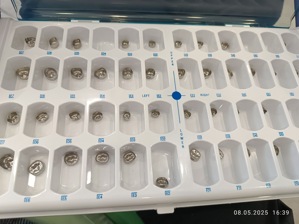 Штампованные коронки, которые ставят детям на молочные зубы.