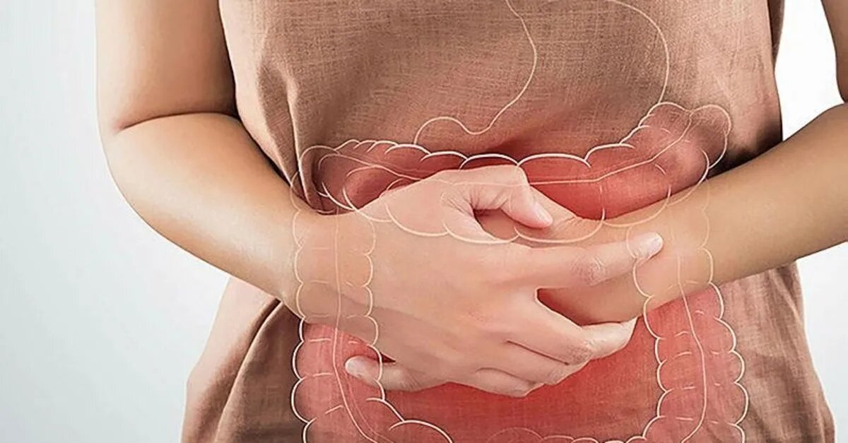 из свободного доступа для иллюстрации статьи