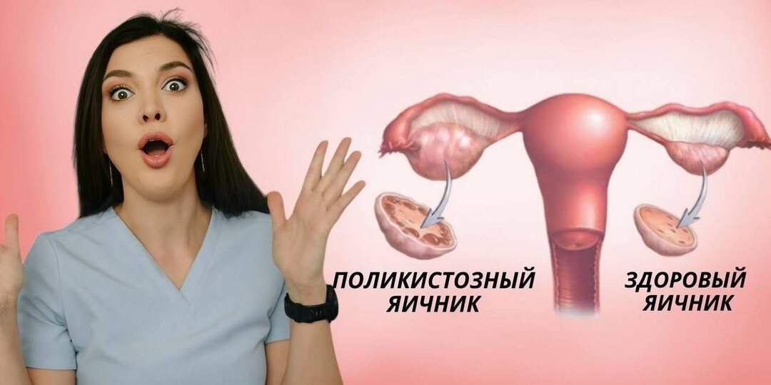 Почему яичники могут перестать работать в 35 +? Гинеколог назвала 5 важных причин, которые не стоит игнорировать