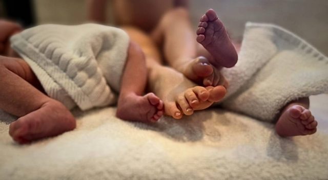    Двойня Эмбер Херд. Фото: социальные сети