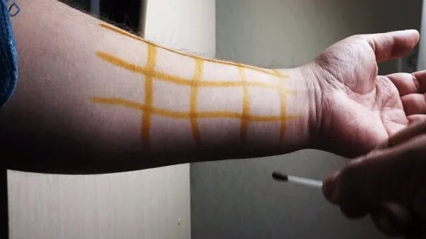 зачем и для чего нужна йодовая сетка 