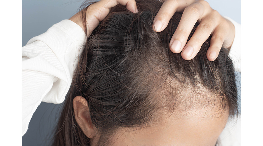 Истончение волос
