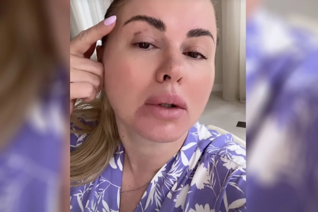    Анна Семенович / фото: соцсети