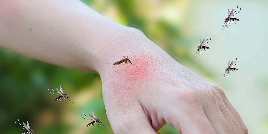 Не страшны ни комары, ни мошки! Облетают меня стороной, а весь секрет довольно прост