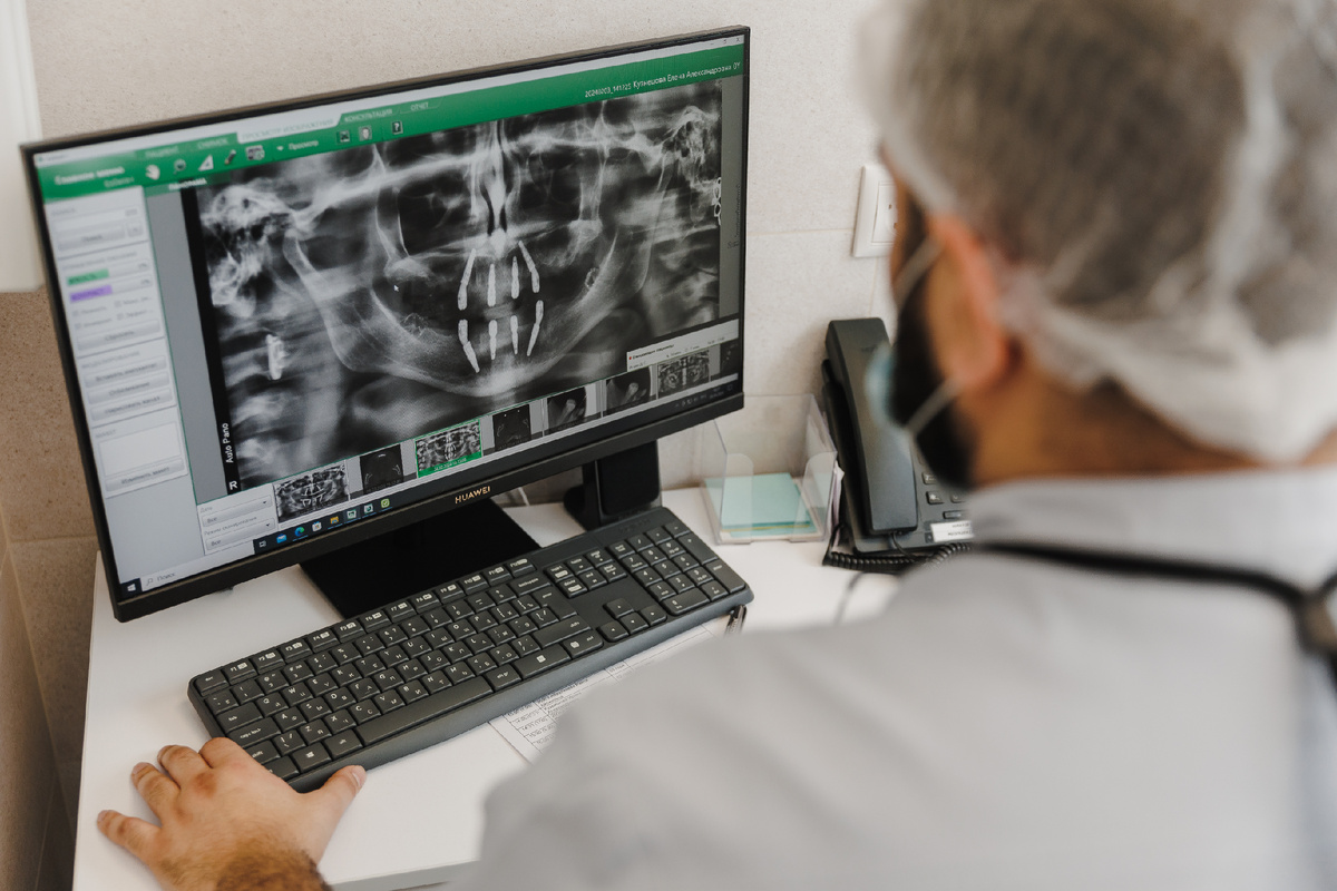 Несъёмное протезирование на 4 имплантах