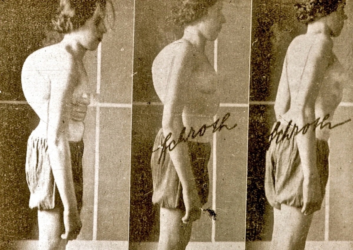 Возникновение и развитие методики с начала XX века до наших дней