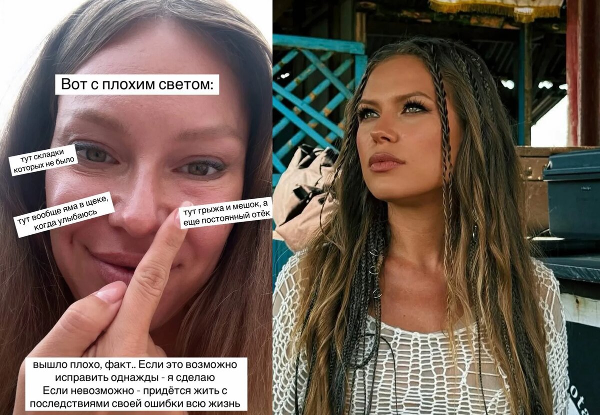 «Лисьи глазки» Риты Дакоты