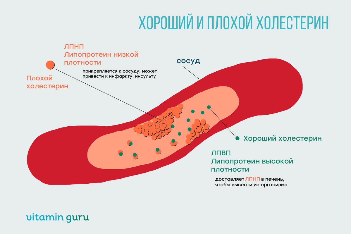 хороший и плохой холестерин