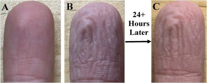    Каждый раз, когда пальцы долго находятся в воде, кожа на них сморщивается одинаково / © Guy German
