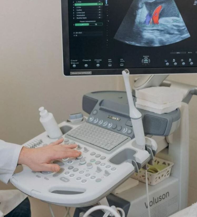 Современный аппарат УЗИ с трансвагинальным датчиком